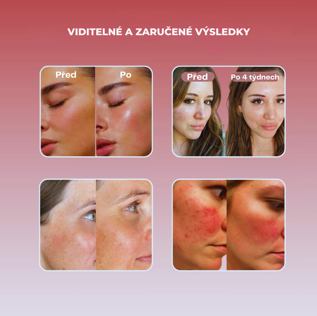 Vivitic Beauty – Hydro Collagen Lift – 1 krabice (10 jednotek) na 4 týdny